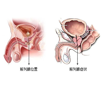 src=http___mn.yuquanhosp.com_uploads_allimg_180801_1-1pp113555d01.jpg&refer=http___mn.yuquanhosp.jpg