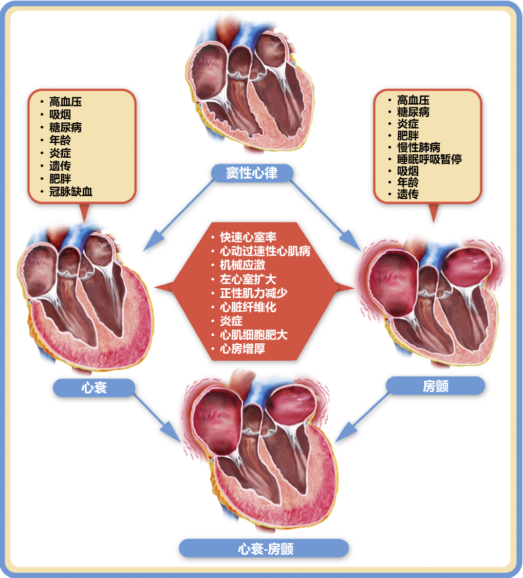 当房颤遇上心衰如何进行抗凝治疗