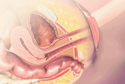 v2-dd7351a508515c42ff938ead1d3cb45f_720w.gif