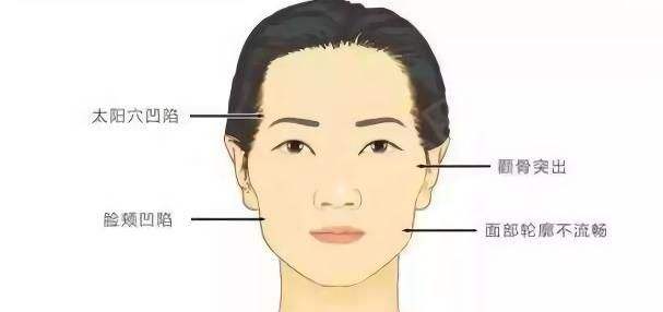 造成面部衰老下垂的主要原因