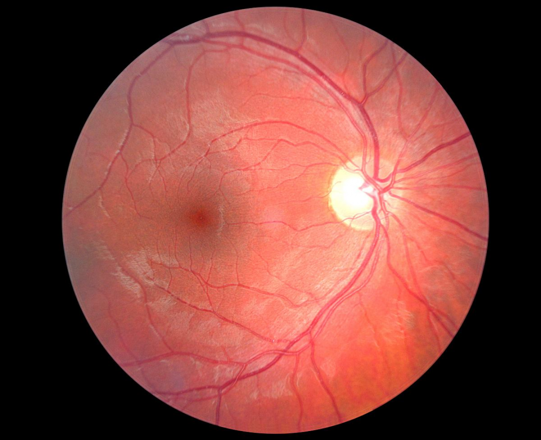 视网膜.jpg